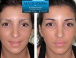 Photo MAQUIDERM INSTITUT - MAQUILLAGE PERMANENT PARIS